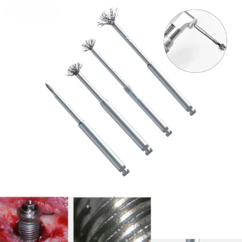 Dental Debridement Peri-Implantitis Implant Surface Titanium Brush for Implant Restoration Maintenance Leaning Dental Tools
Dental Debridement Peri-Implantitis Implant Surface Titanium Brush for Implant Restoration Maintenance Leaning Dental Tools