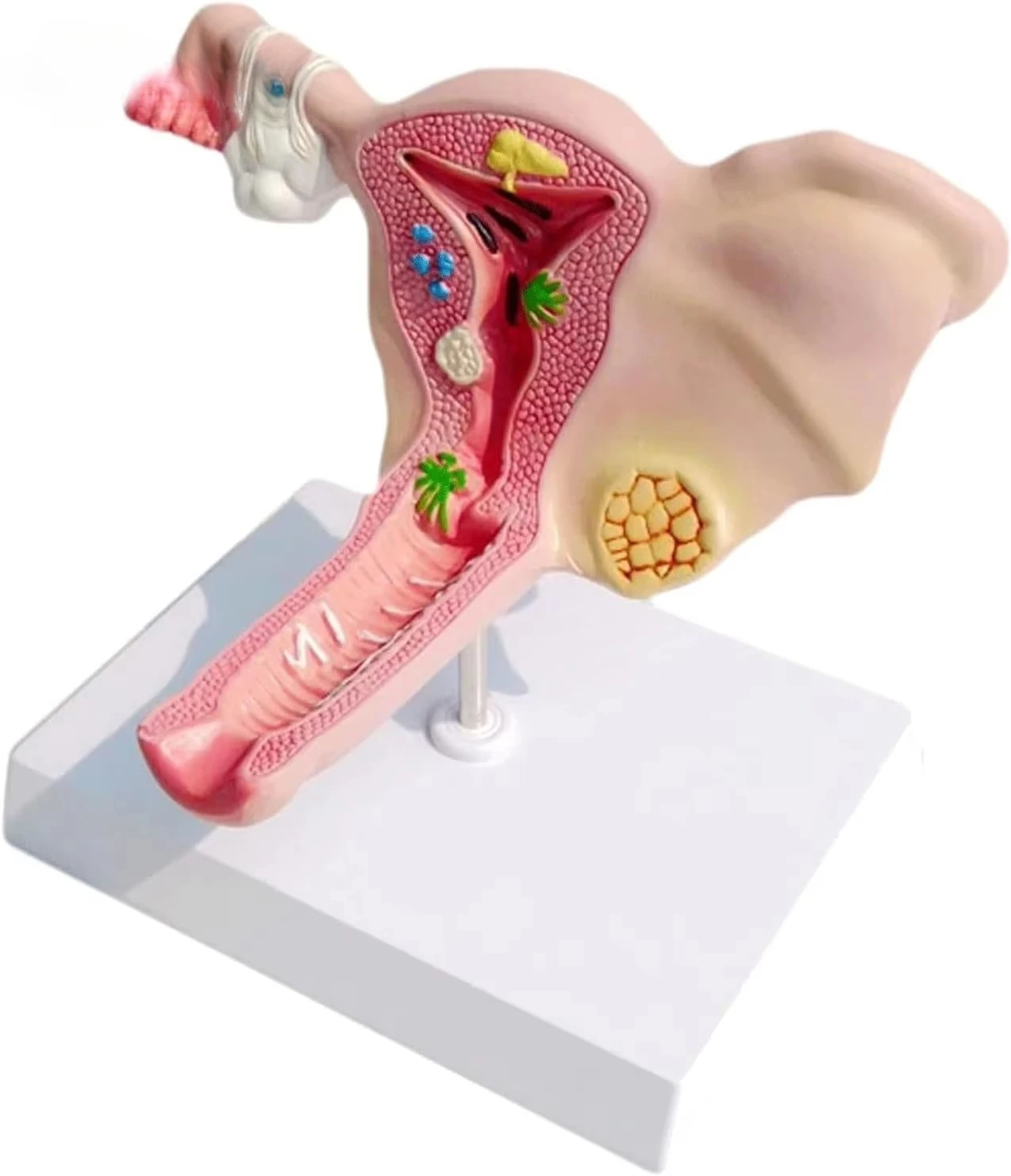 Анатомическая модель женской матки, ovaries и репродуктивной структуры в медицине.
Анатомическая модель женской матки, ovaries и репродуктивной структуры в медицине.
