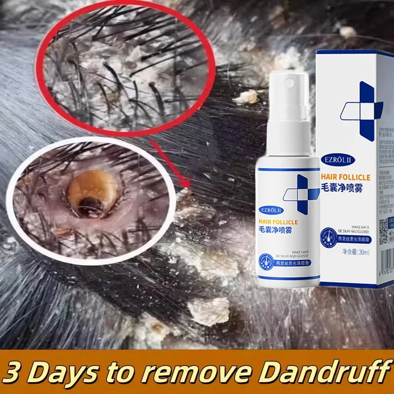 Hair Treatment Remove Dandruff Relieve Essence Spray Prevent Loss Serum Oil Control Smooth Nourish Repair Hair Scalp Care
Hair Treatment Remove Dandruff Relieve Essence Spray Prevent Loss Serum Oil Control Smooth Nourish Repair Hair Scalp Care