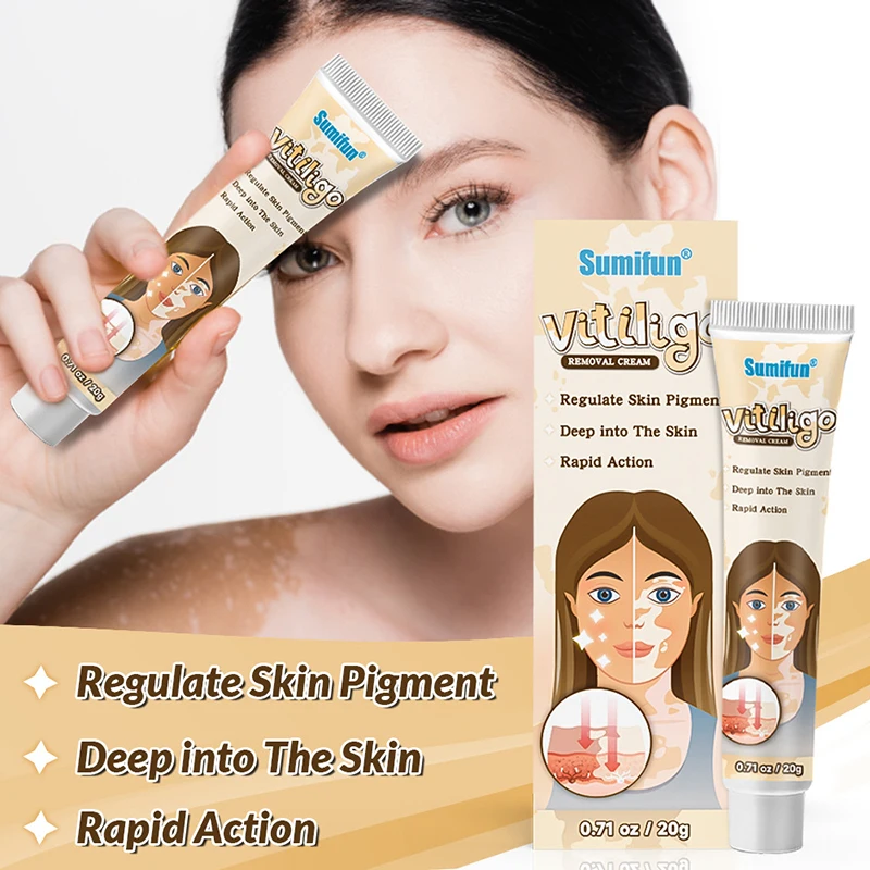 Vitiligo Repair Cream Remove Vitiligo Ointment Remove Ringworm White Spot Removal Upgraded White Spot Treatment Cream Skin Care
Vitiligo Repair Cream Remove Vitiligo Ointment Remove Ringworm White Spot Removal Upgraded White Spot Treatment Cream Skin Care