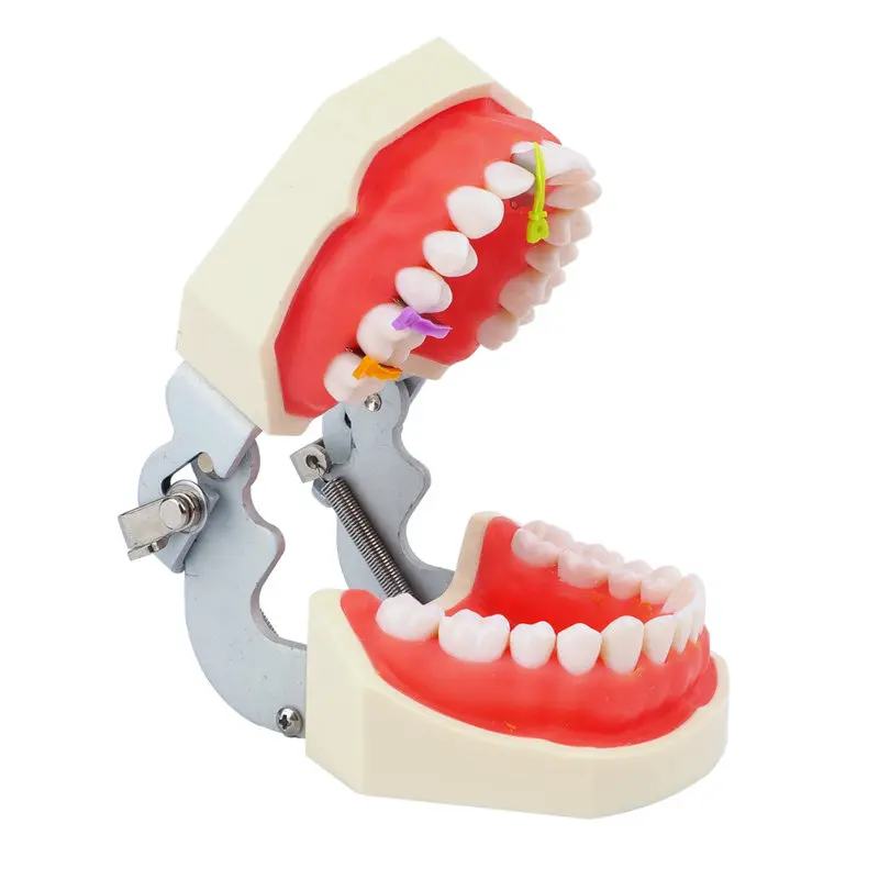 50Pcs/Box Dental Color Coded Interdental Wedge Guard Dental Matrix System Preventing Iatrogenic Bur Damage To Adjacent Teeth
50Pcs/Box Dental Color Coded Interdental Wedge Guard Dental Matrix System Preventing Iatrogenic Bur Damage To Adjacent Teeth