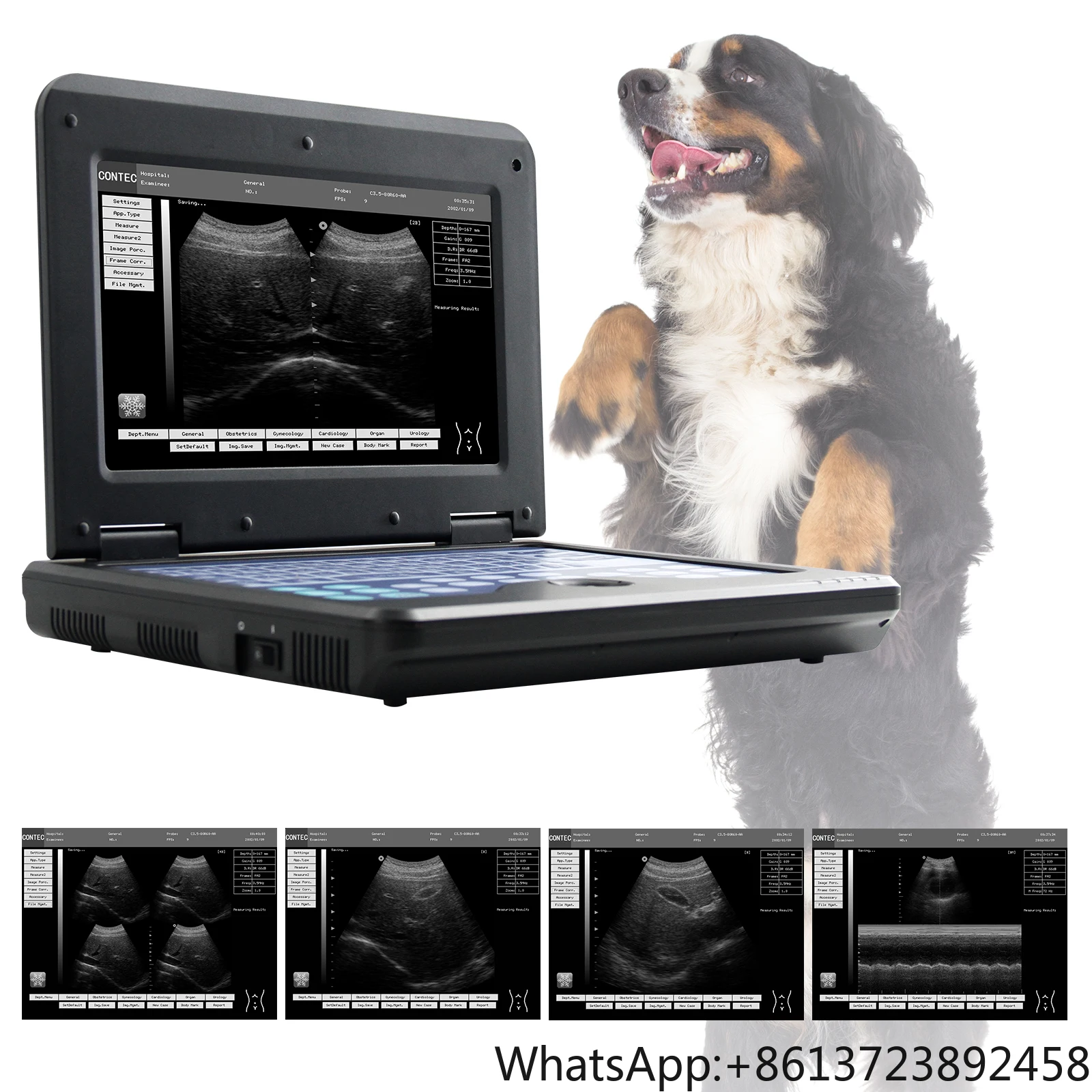 JYTOP CMS600P2 VET Veterinary Pet Ultrasound Machine for Animal Dog Ultrasound Ultrasonic Equipment
JYTOP CMS600P2 VET Veterinary Pet Ultrasound Machine for Animal Dog Ultrasound Ultrasonic Equipment