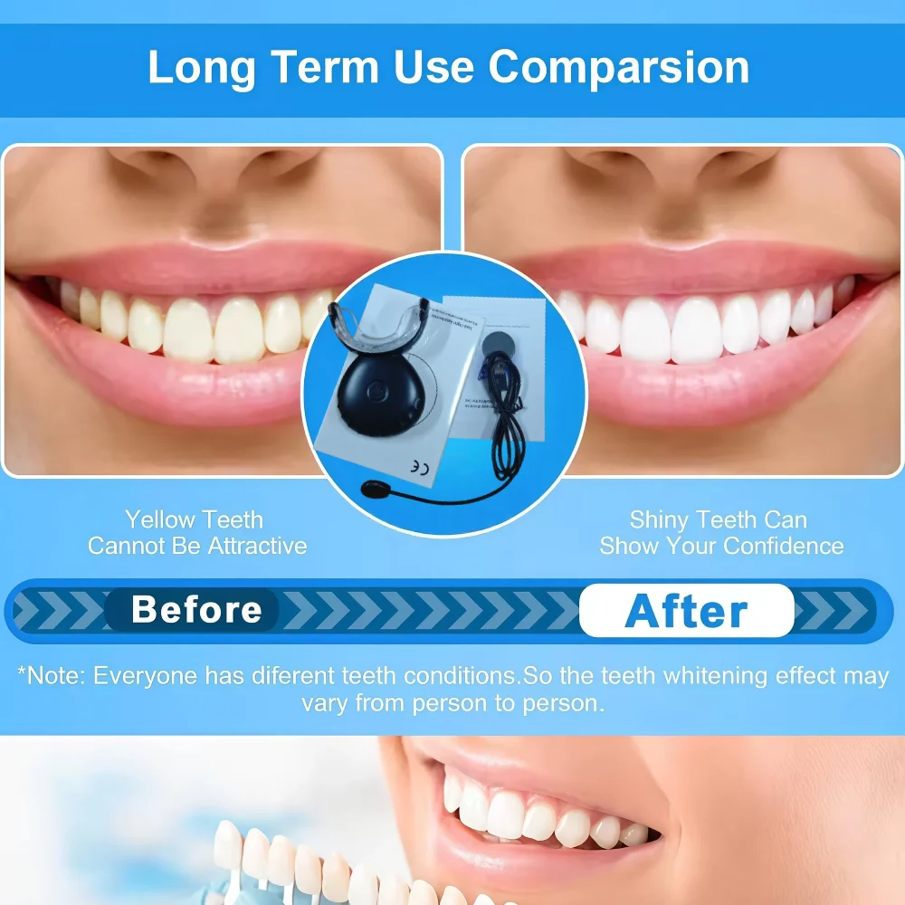 Red Blue Light Dental Care Device, Provides Immediate Relief for Toothache & Gum Sensitivity
Red Blue Light Dental Care Device, Provides Immediate Relief for Toothache & Gum Sensitivity