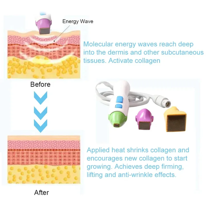 2025 AOKO 3-in-1 Facial Care Machine Skin Rejuvenation Anti-Aging Face Lifting & Wrinkle Removal Device for Body Skin Strengthen 
2025 AOKO 3-in-1 Facial Care Machine Skin Rejuvenation Anti-Aging Face Lifting & Wrinkle Removal Device for Body Skin Strengthen