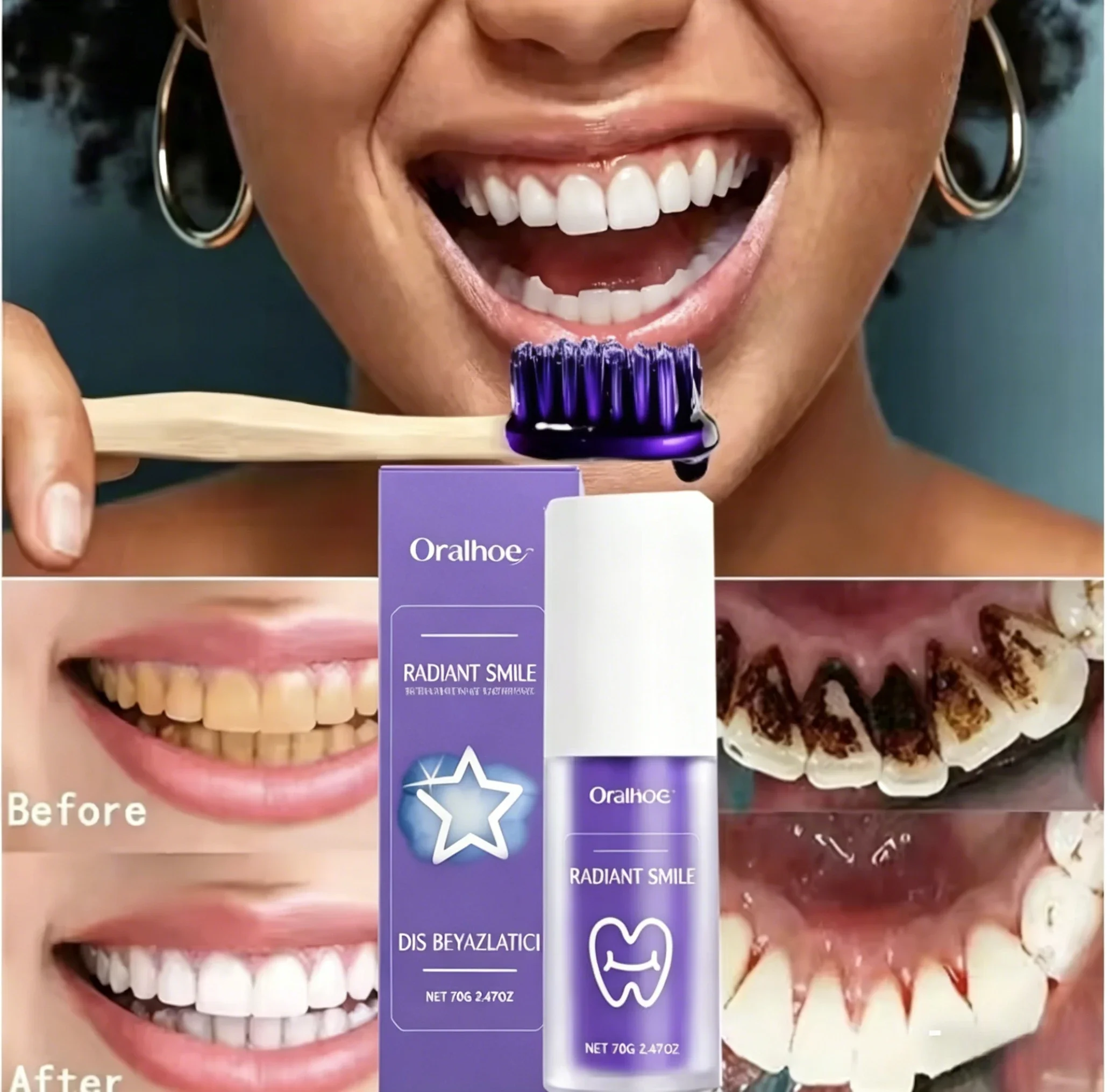 ORALHOE 50g Purple Teeth Whitening Toothpaste Remove Plaque Stains Cleaning Oral Hygiene Dental Bleach Tools Fresh Breath
ORALHOE 50g Purple Teeth Whitening Toothpaste Remove Plaque Stains Cleaning Oral Hygiene Dental Bleach Tools Fresh Breath