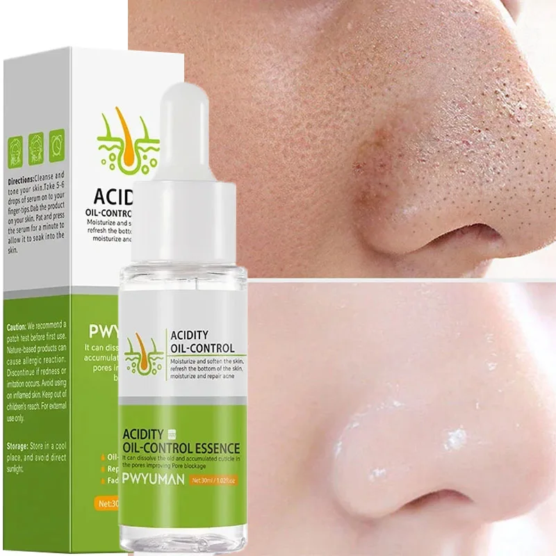 Lactobionic Acid Pore Shrinking Facial Serum Pores Acne Treatment Blackhead Removal Repairing Gel Oil Control Smooth Skin Care
Lactobionic Acid Pore Shrinking Facial Serum Pores Acne Treatment Blackhead Removal Repairing Gel Oil Control Smooth Skin Care