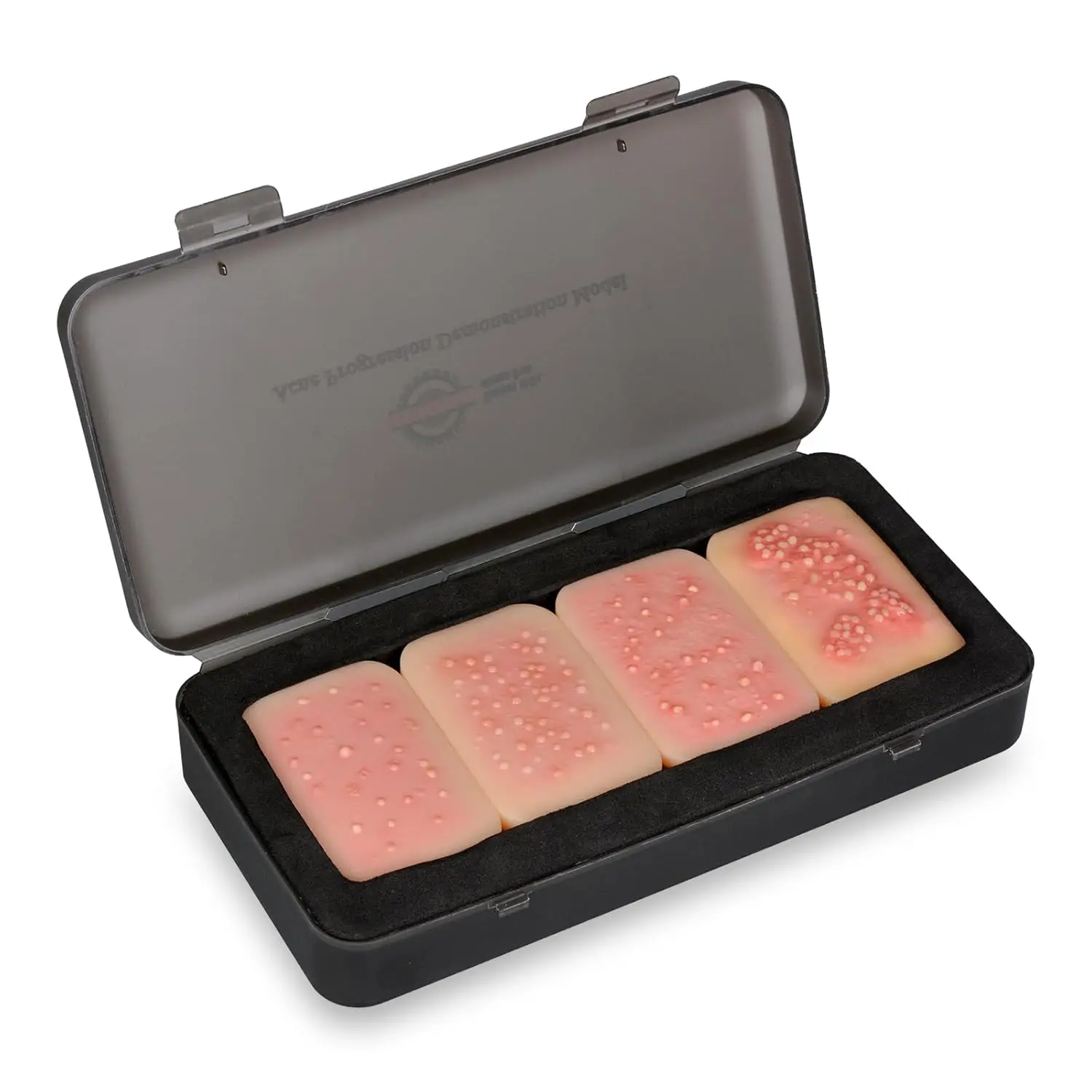 Complete Acne Progression Demonstration Model Visual Teaching Skin-Like Silicone for Dermatology Nursing & Medical Education
Complete Acne Progression Demonstration Model Visual Teaching Skin-Like Silicone for Dermatology Nursing & Medical Education