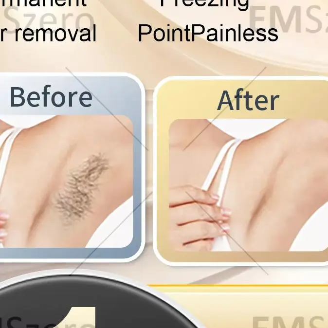 Professional 4500W Alexandrite Ice Platinum Diode Laser Epilator Permanent Painless Body Hair Removal Beauty Machine For Women
Professional 4500W Alexandrite Ice Platinum Diode Laser Epilator Permanent Painless Body Hair Removal Beauty Machine For Women