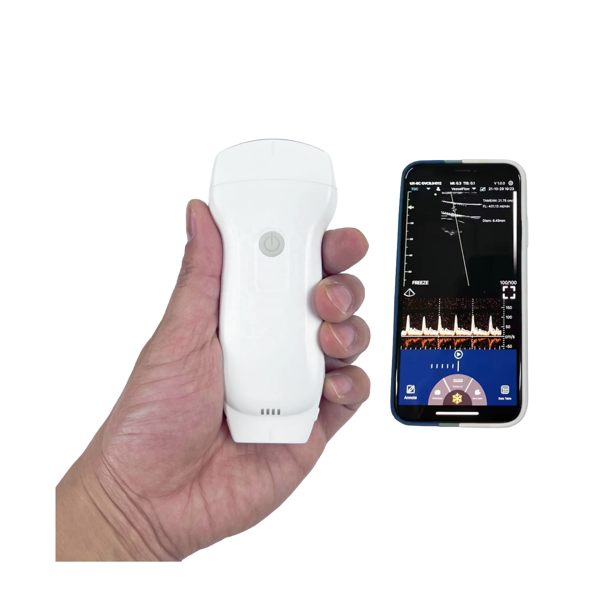 Portable Veterinary Ultrasound Equipment Cow / Horse / Goat / Pig Pregnancy4d Ultrasound Scanner Echograph Machine Electric CE
Portable Veterinary Ultrasound Equipment Cow / Horse / Goat / Pig Pregnancy4d Ultrasound Scanner Echograph Machine Electric CE