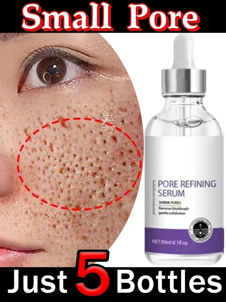 Skin Texture | Pore Refining Resurfacing, Brightening Facial Serum with Retinol and Niacinamide Non-Comedogenic
Skin Texture | Pore Refining Resurfacing, Brightening Facial Serum with Retinol and Niacinamide Non-Comedogenic