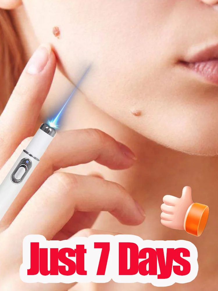 Warts blue light tool, more discounts on sets
Warts blue light tool, more discounts on sets