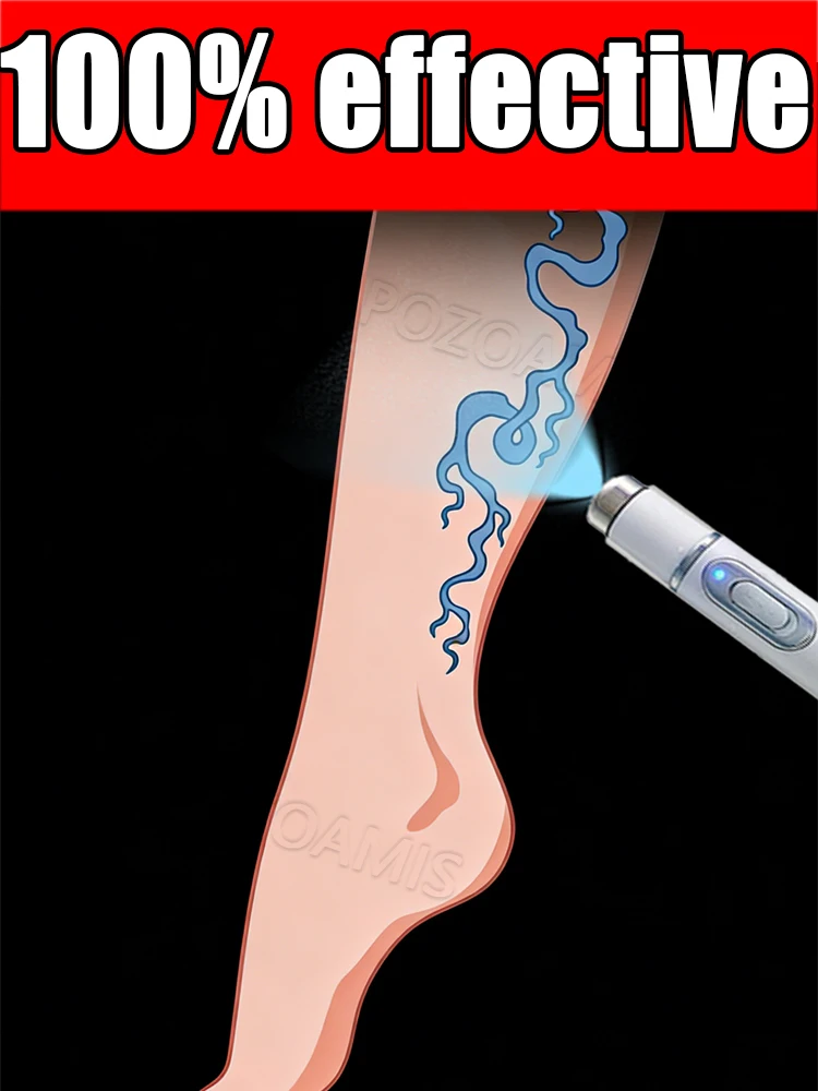 The latest generation of blue light pens
The latest generation of blue light pens