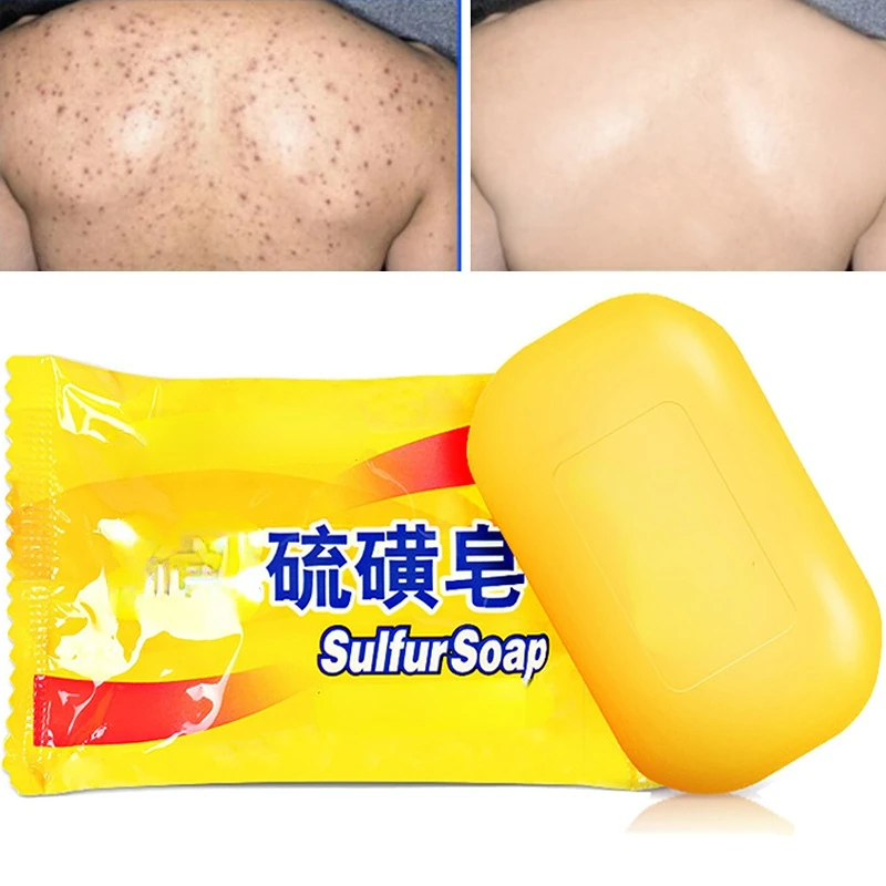 70g Sulfur Soap Acne Treatment Blackhead Remover Soap Whitening Cleanser Oil-control Chinese Traditional Skin Care 1pc
70g Sulfur Soap Acne Treatment Blackhead Remover Soap Whitening Cleanser Oil-control Chinese Traditional Skin Care 1pc