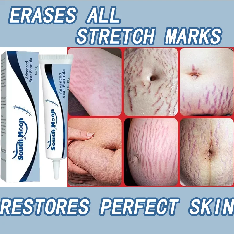 7 Days Stretch Marks cream For Pregnancy Remove Postpartum Obesity Women Scar Without Side Effect Butt Firm Lift Skin Body Cream
7 Days Stretch Marks cream For Pregnancy Remove Postpartum Obesity Women Scar Without Side Effect Butt Firm Lift Skin Body Cream