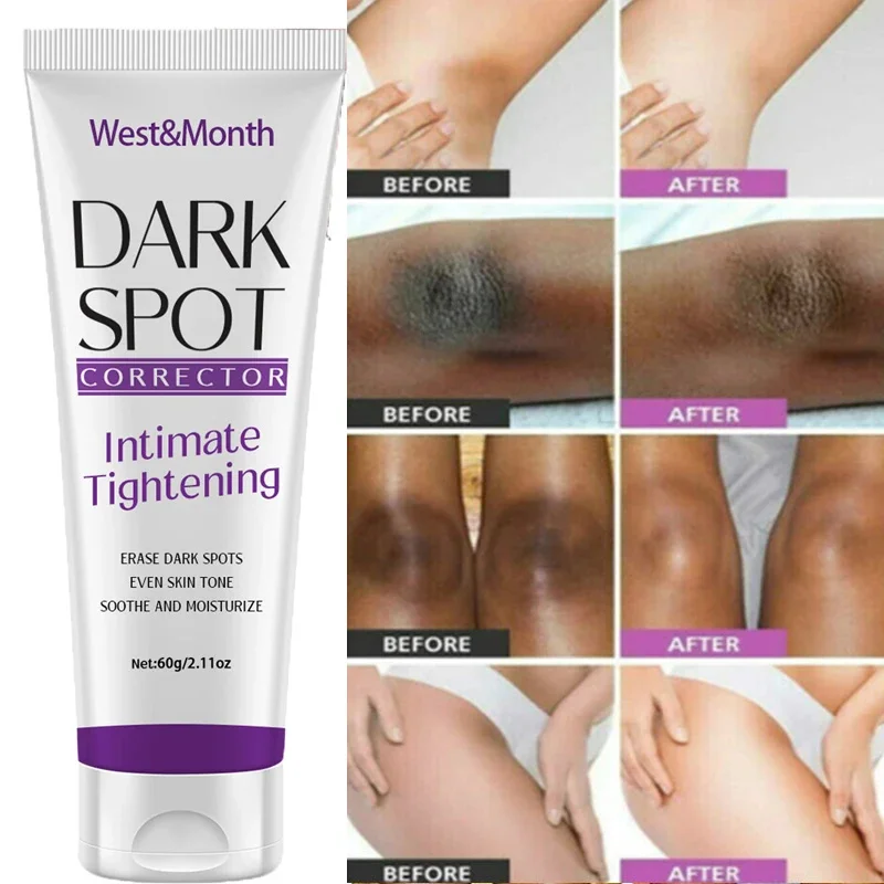 Nicotinamide Brightening Cream For Dark Skin Effective Lighten Thigh Inner Bleach Remove Melanin Private Parts Brighten Cream
Nicotinamide Brightening Cream For Dark Skin Effective Lighten Thigh Inner Bleach Remove Melanin Private Parts Brighten Cream