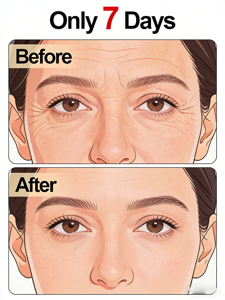 2026 Bestselling Facial Serum,No fine lines ,For wrinkles and does not look old For Smooth Delicate Complexion
2026 Bestselling Facial Serum,No fine lines ,For wrinkles and does not look old For Smooth Delicate Complexion