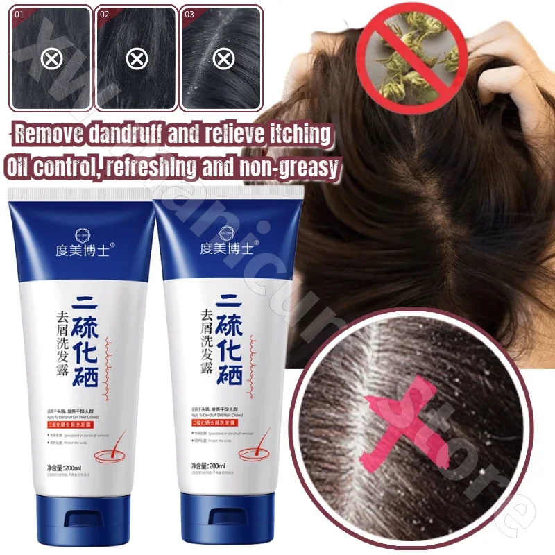 Scalp Deep Oil Control Cleans Scalp Pores Shampoo Removes Mites and Relieves Itching Refreshing Non-greasy Shampoo Moisturizing
Scalp Deep Oil Control Cleans Scalp Pores Shampoo Removes Mites and Relieves Itching Refreshing Non-greasy Shampoo Moisturizing