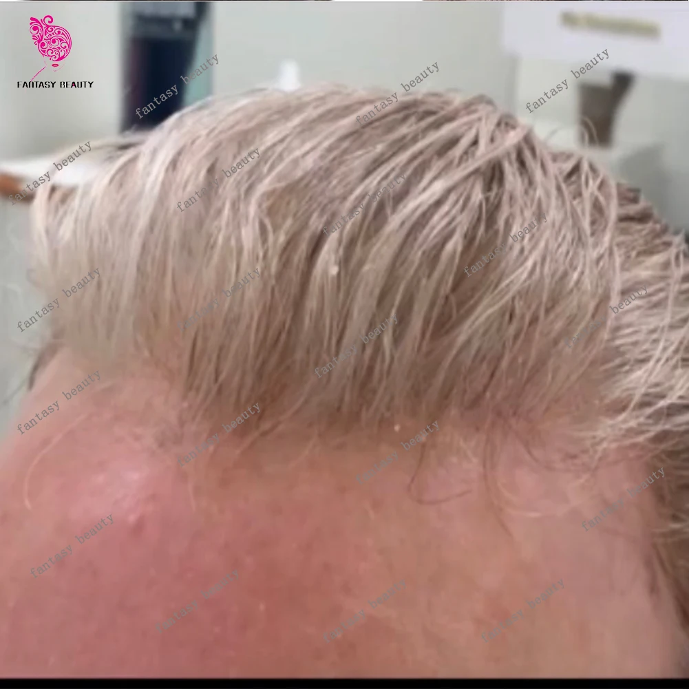 Natural 90Density 0.02mm Grey 1b80 Capillary Prosthesis System Hairpieces Super Thin Skin Natural Hairline Human Hair Men Toupee
Natural 90Density 0.02mm Grey 1b80 Capillary Prosthesis System Hairpieces Super Thin Skin Natural Hairline Human Hair Men Toupee