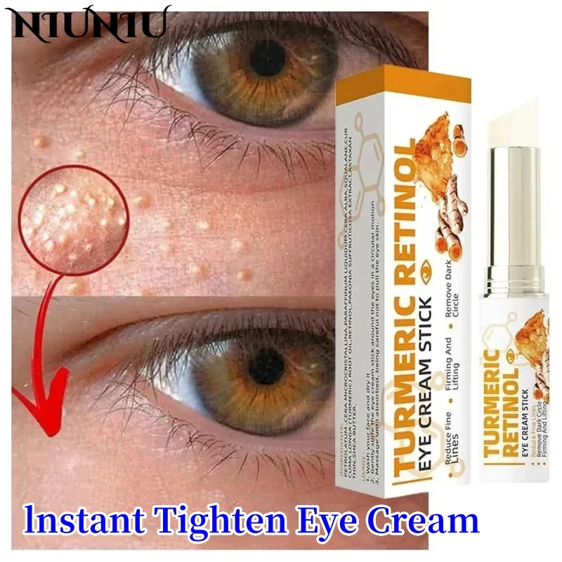 Anti Fat Particles Dark Circles Puffiness Fade Fine Lines Lift Brighten Korean Beauty Eye Care Instant Eye Bag Remove Eye Cream
Anti Fat Particles Dark Circles Puffiness Fade Fine Lines Lift Brighten Korean Beauty Eye Care Instant Eye Bag Remove Eye Cream