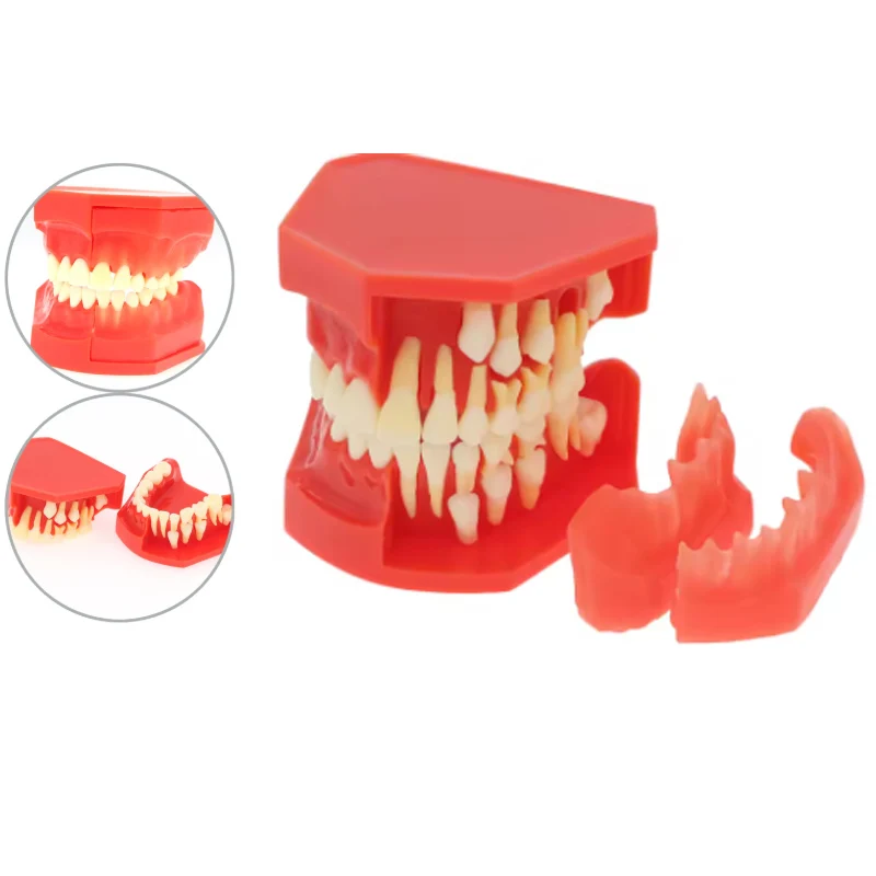 1Pcs Dental Children's Milk Teeth Alternation Model Permanent Teeth Replacement Progress Model Dental Teaching Model 3 Age stage
1Pcs Dental Children's Milk Teeth Alternation Model Permanent Teeth Replacement Progress Model Dental Teaching Model 3 Age stage