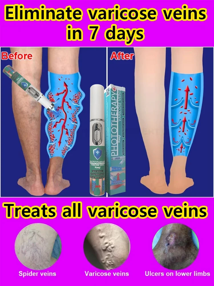 Reduces Spider Veins and Heaviness | for Sensitive and Couperose Skin | Varicose vein laser pointer
Reduces Spider Veins and Heaviness | for Sensitive and Couperose Skin | Varicose vein laser pointer