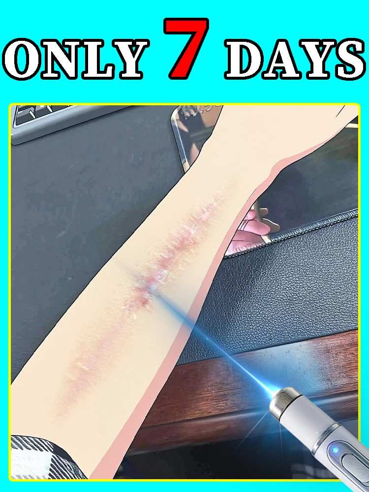 Пᵒпʸляᵖᴴᵒᵉ ᵇ ²⁰²⁵ гᵒдʸ ᶜᵖᵉдᶜтᵇᵒ для ᵇᵒᶜᶜтᵃᴴᵒᵇлᵉᴴия ᶜиᴴᵉгᵒ ᶜᵇᵉтᵃ⸴ ᶜдᵉлᵃйтᵉ ᶜᵇᵒю ᵏᵒжʸ здᵒᵖᵒᵇᵒй и ᵉᶜтᵉᶜтᵇᵉᴴᴴᵒй!
Пᵒпʸляᵖᴴᵒᵉ ᵇ ²⁰²⁵ гᵒдʸ ᶜᵖᵉдᶜтᵇᵒ для ᵇᵒᶜᶜтᵃᴴᵒᵇлᵉᴴия ᶜиᴴᵉгᵒ ᶜᵇᵉтᵃ⸴ ᶜдᵉлᵃйтᵉ ᶜᵇᵒю ᵏᵒжʸ здᵒᵖᵒᵇᵒй и ᵉᶜтᵉᶜтᵇᵉᴴᴴᵒй!