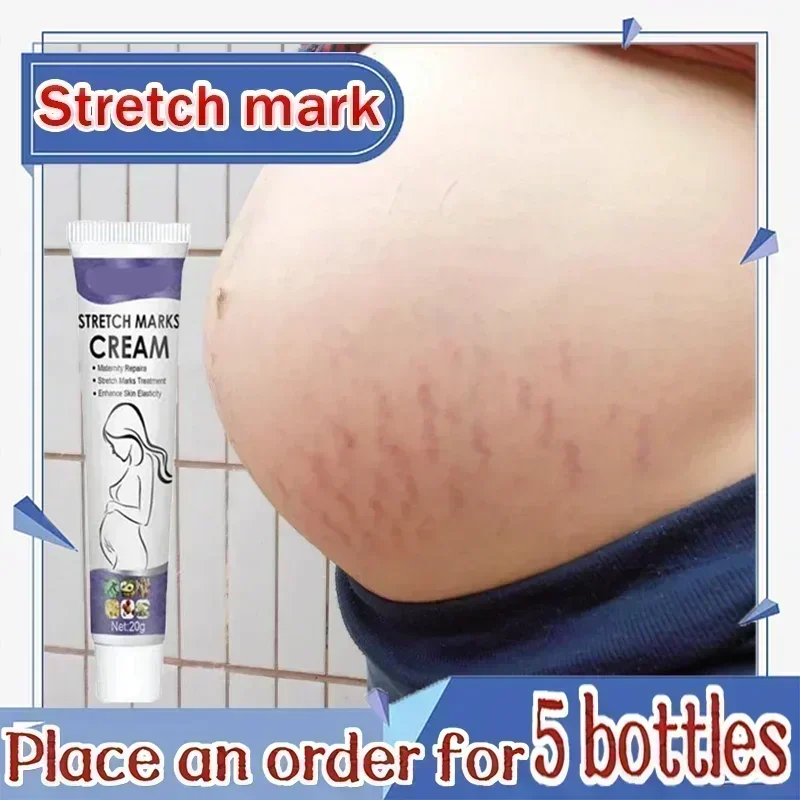 02HOT Stretch Marks Treatment Repair Essential Oil Skin Care Cream For Maternity Remover Anti-Wrinkle Slackline For Pregnant B
02HOT Stretch Marks Treatment Repair Essential Oil Skin Care Cream For Maternity Remover Anti-Wrinkle Slackline For Pregnant B