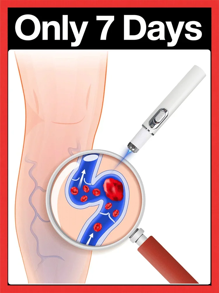 Стиль внутрипарации, косяки для детей, автомобильный лазер
Стиль внутрипарации, косяки для детей, автомобильный лазер