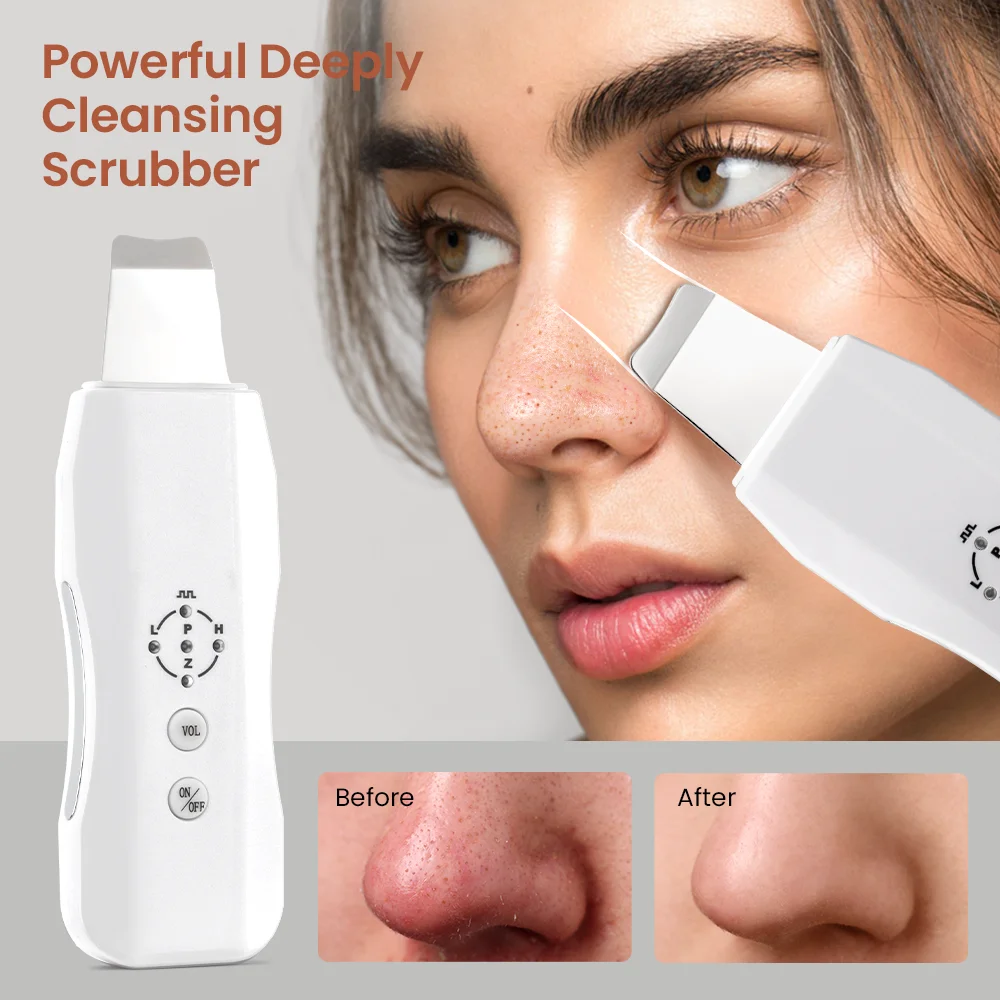 facial ultrasonic cleaner Deeply clean skin Blackhead Remover Remove dead skin skincare equipment
facial ultrasonic cleaner Deeply clean skin Blackhead Remover Remove dead skin skincare equipment 
