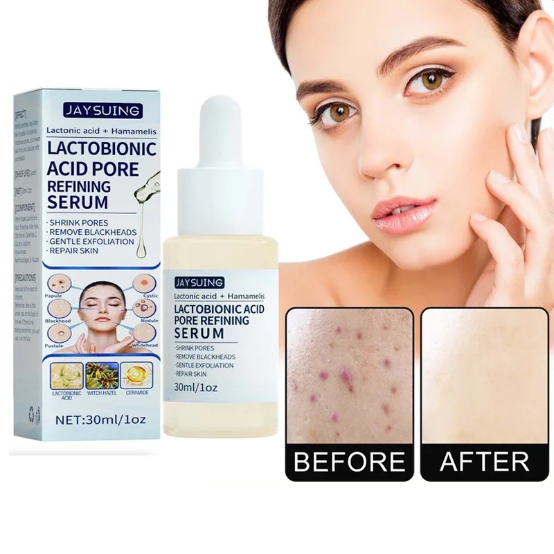 Lactic acid essence exfoliating melanin essence facial firming lifting moisturizing essence
Lactic acid essence exfoliating melanin essence facial firming lifting moisturizing essence