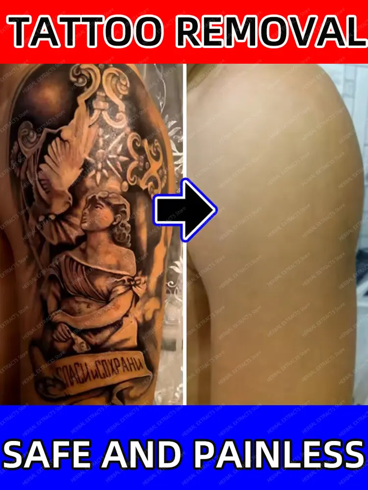 Tattoo removal cream, suitable for large and small tattoos, effective in removing permanent tattoos
Tattoo removal cream, suitable for large and small tattoos, effective in removing permanent tattoos