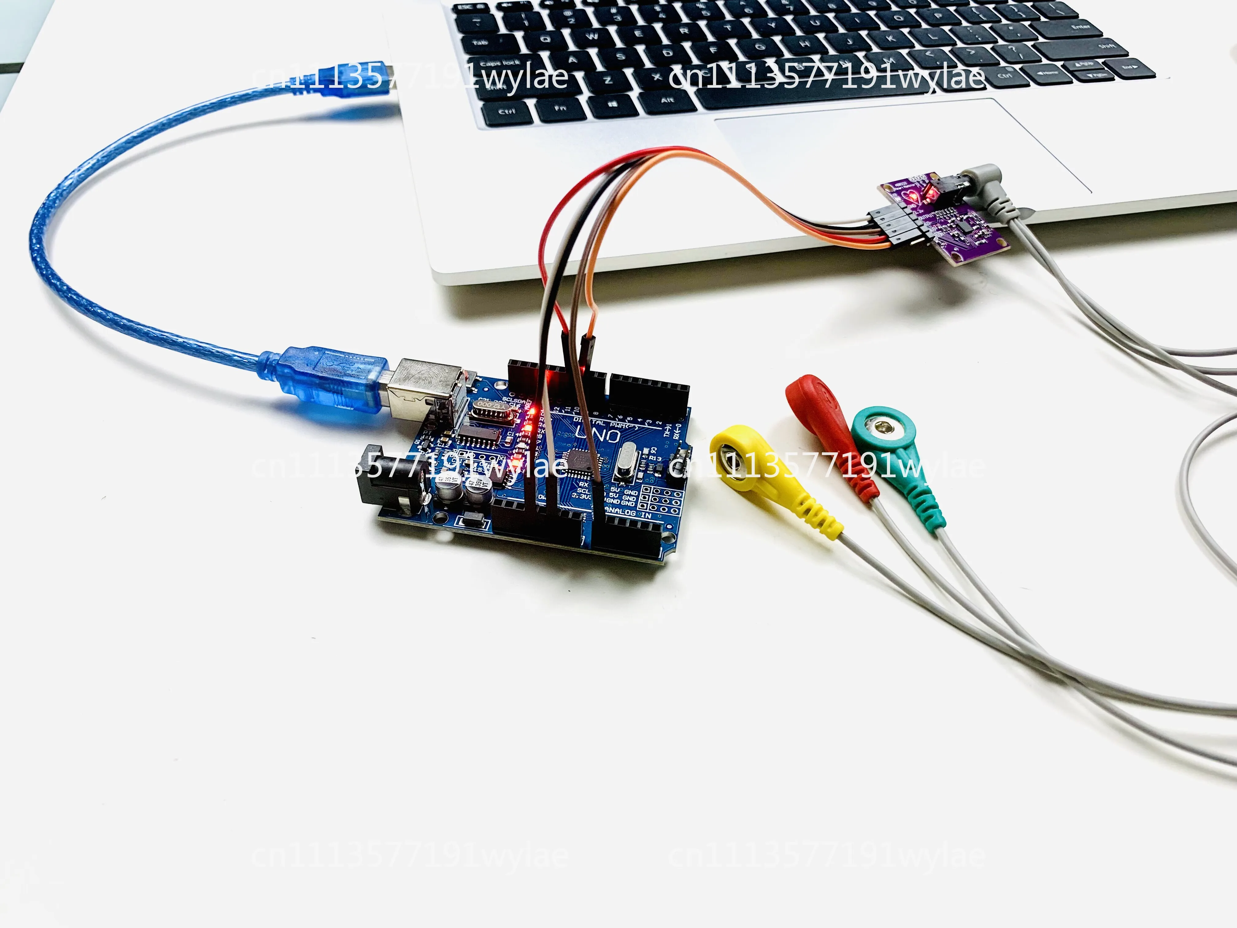 Heart rate ECG acquisition module, physiological pulse detection, ECG AD8232 bioelectrical signal development kit
Heart rate ECG acquisition module, physiological pulse detection, ECG AD8232 bioelectrical signal development kit