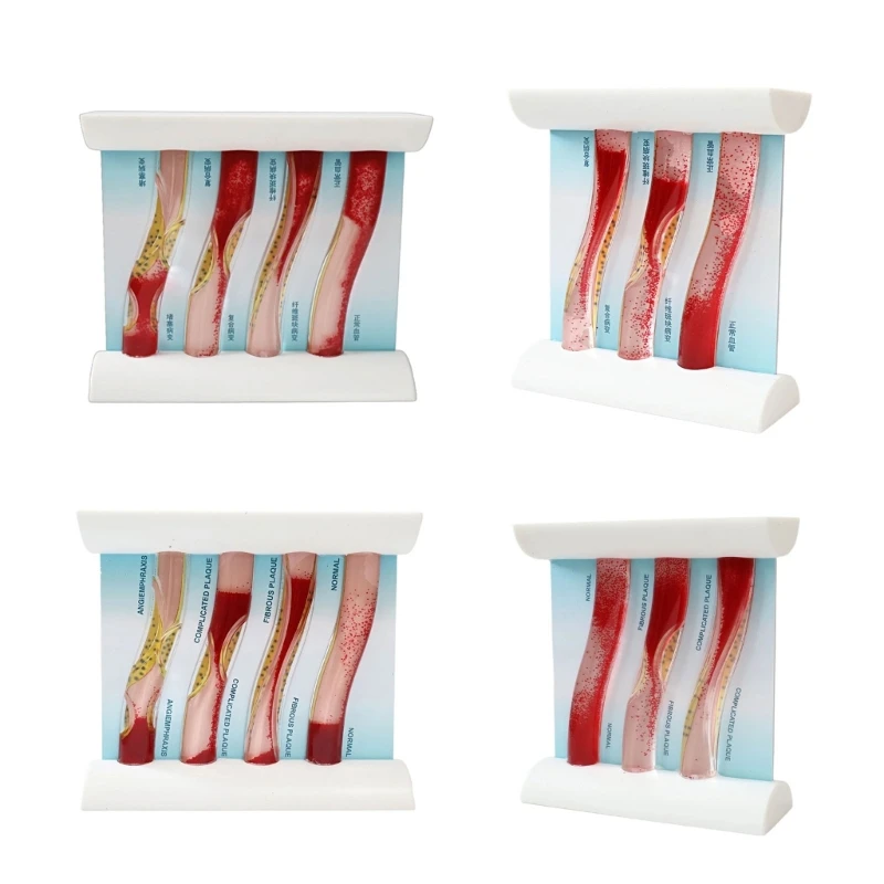 High Quality Simulated Blood Vessel Teaching Aid Vascular Model With Movable Blood And Multiple Pathology Examples X37A
High Quality Simulated Blood Vessel Teaching Aid Vascular Model With Movable Blood And Multiple Pathology Examples X37A