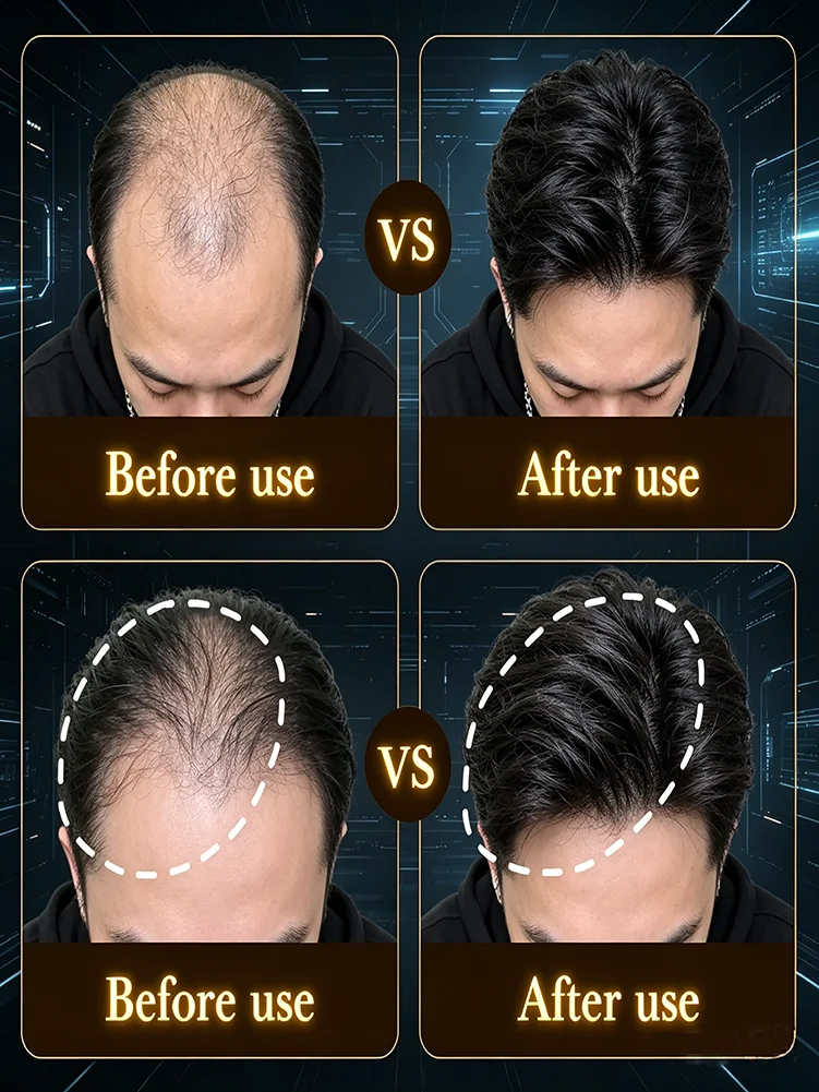 It absorbs quickly, improves the scalp environment, promotes hair growth, and has remarkable effects; 99% of users choose it.
It absorbs quickly, improves the scalp environment, promotes hair growth, and has remarkable effects; 99% of users choose it.