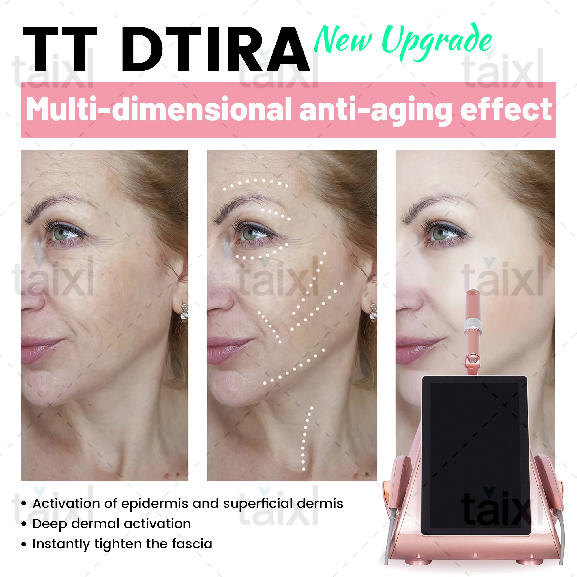 Умный экран HD с мультизондом 5,5 МГц/4 МГц/2 МГц для подтяжки кожи, продукт для личной гигиены
Умный экран HD с мультизондом 5,5 МГц/4 МГц/2 МГц для подтяжки кожи, продукт для личной гигиены