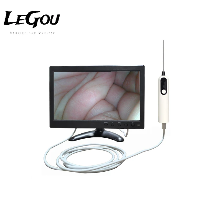 Veterinary Endoscope High Definition Image Processor Factory Direct Sales Single Use UreteroscopeLeGou Professional
Veterinary Endoscope High Definition Image Processor Factory Direct Sales Single Use UreteroscopeLeGou Professional