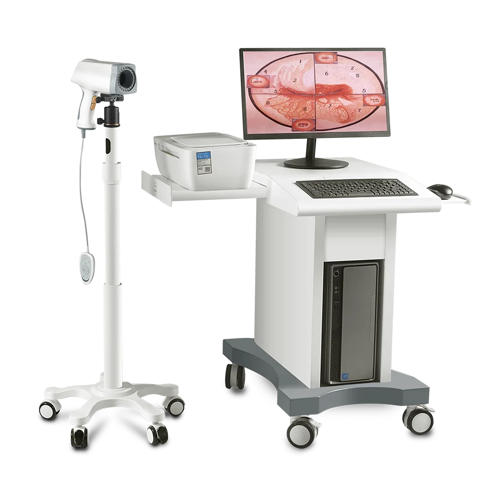 Высококачественная цифровая Больничная смотровая система Colposcopy с принтером
Высококачественная цифровая Больничная смотровая система Colposcopy с принтером