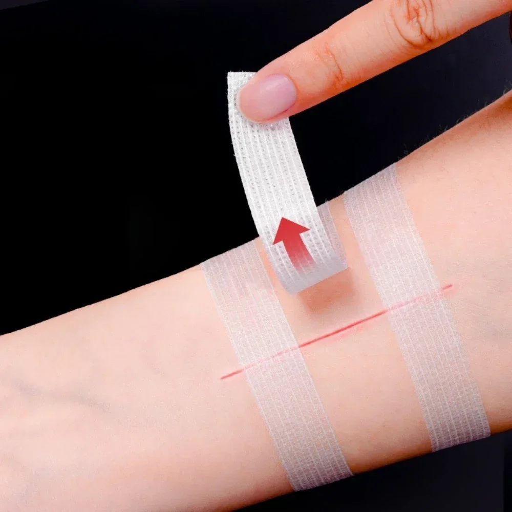 Fter Caesarean Section Skin Wound Repair Skin Closure Strips Medical Non-seam Tape Profession Cosmetic Surgery Child Face Tapes
Fter Caesarean Section Skin Wound Repair Skin Closure Strips Medical Non-seam Tape Profession Cosmetic Surgery Child Face Tapes