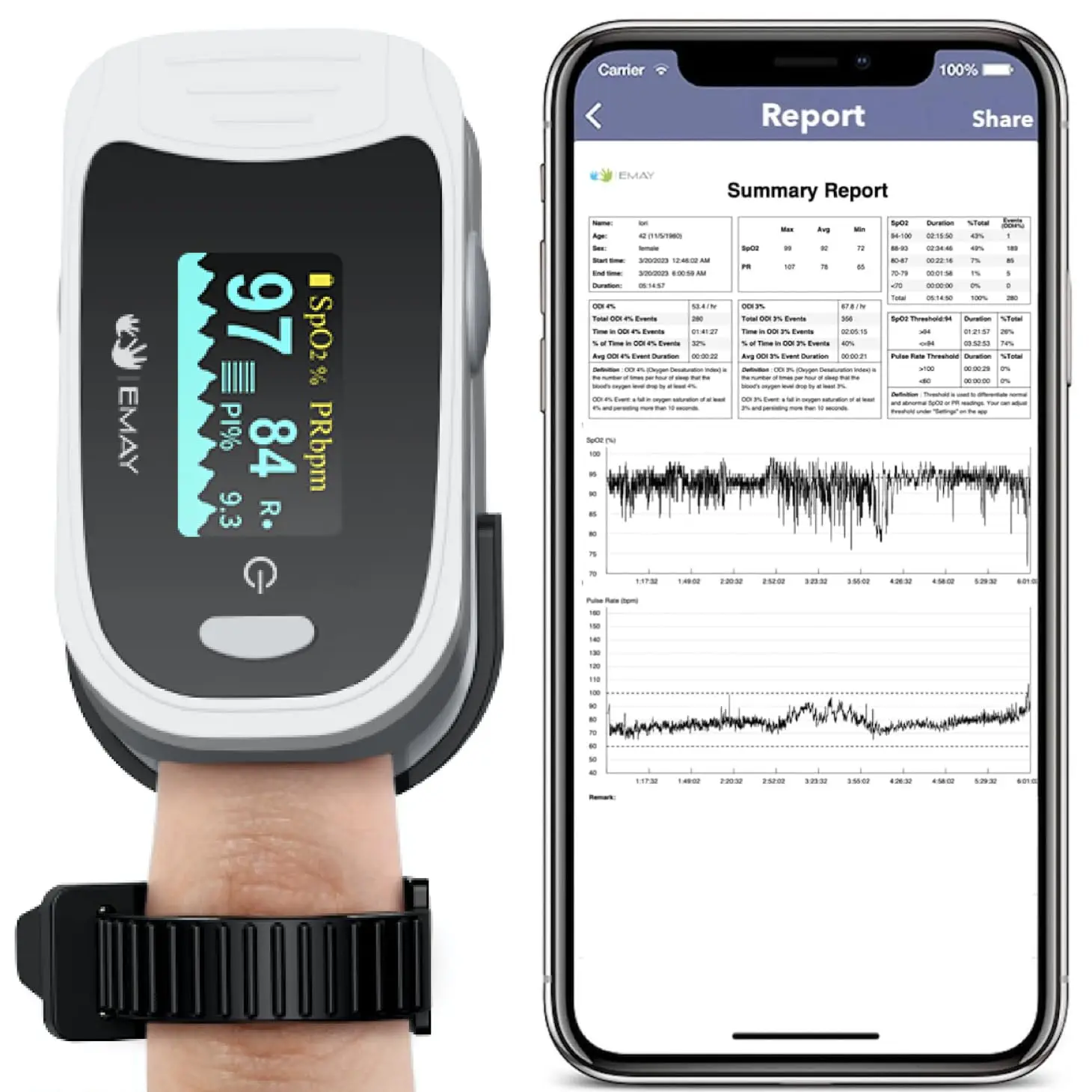 Sleep Oxygen Monitor with Recording | Track Overnight Blood Oxygen & Pulse Rate | Provides Sleep Report & Raw Data
Sleep Oxygen Monitor with Recording | Track Overnight Blood Oxygen & Pulse Rate | Provides Sleep Report & Raw Data