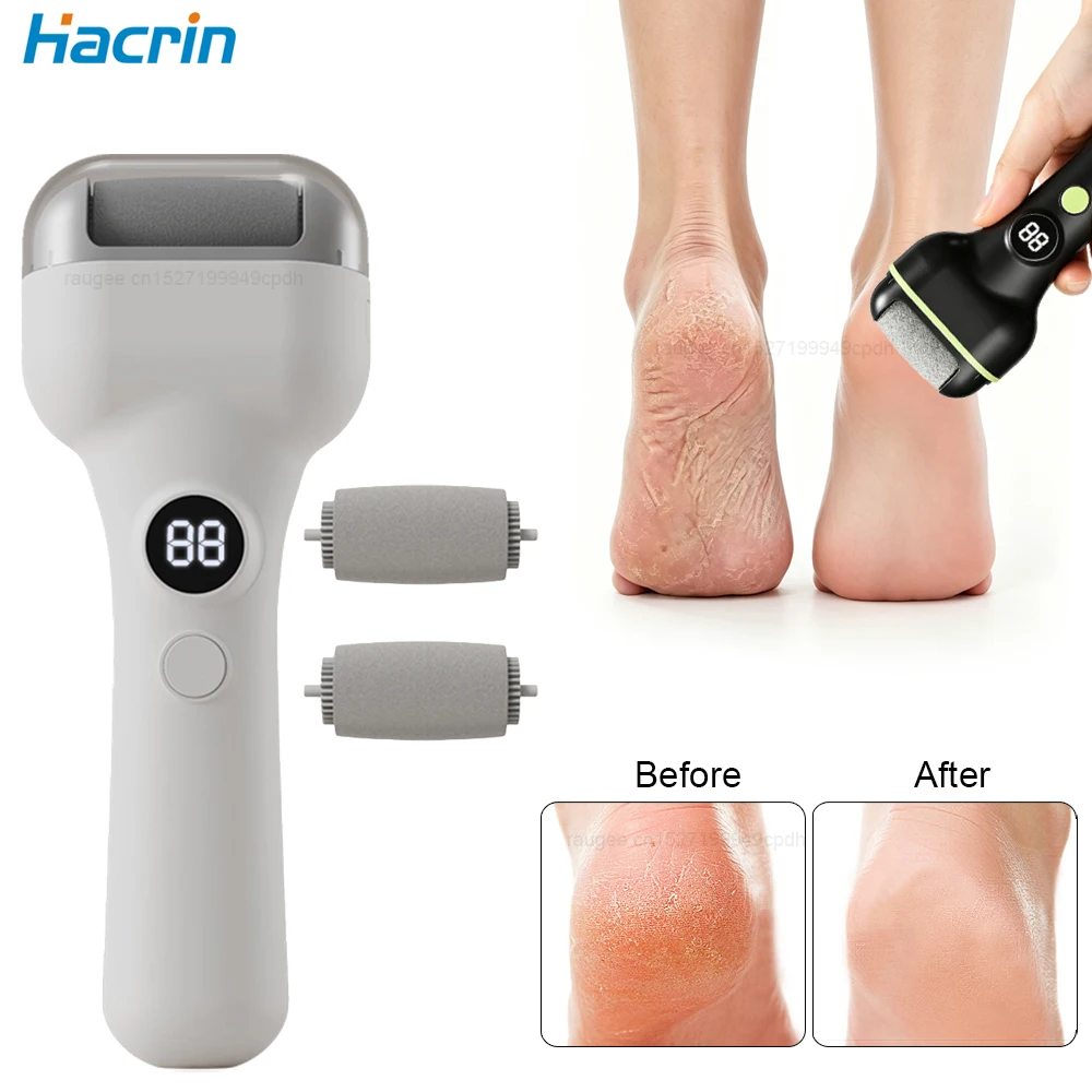 Electric Foot Callus Remover Portable Electronic Foot File Rechargeable Foot Scrubber File Pedicure Kits for Dead Skin Dry Skin
Electric Foot Callus Remover Portable Electronic Foot File Rechargeable Foot Scrubber File Pedicure Kits for Dead Skin Dry Skin