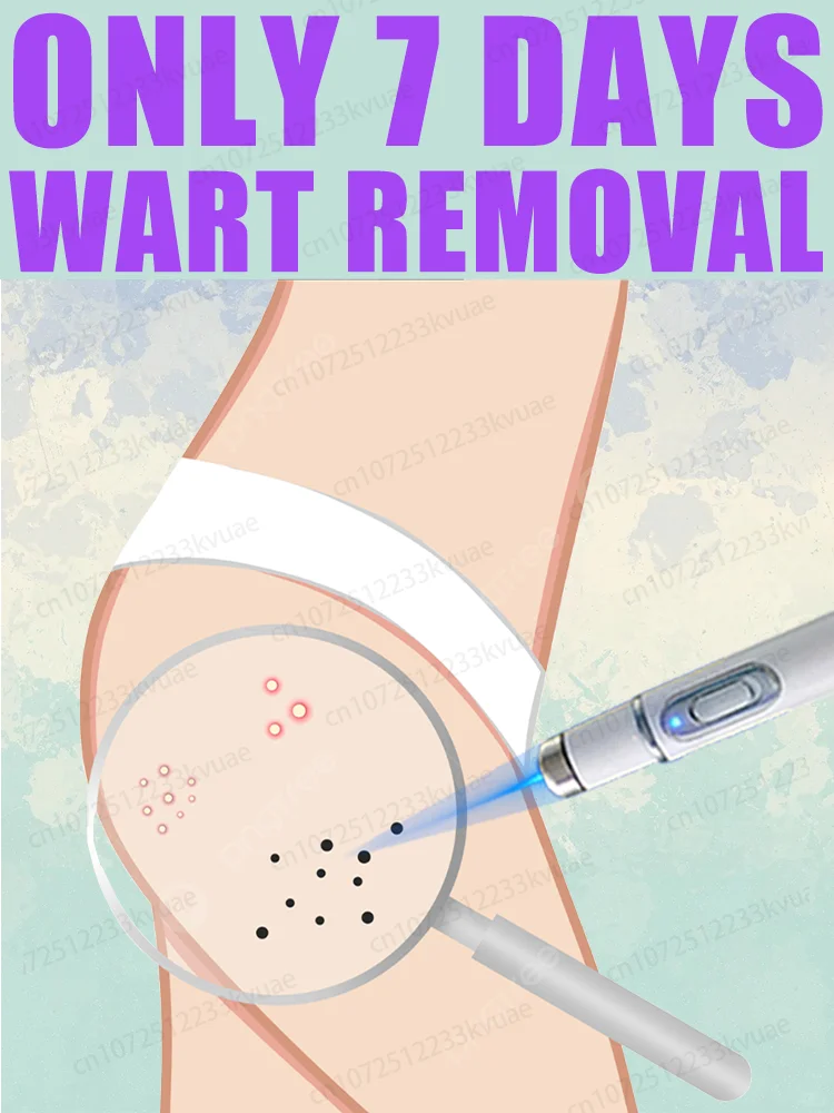 Warts blue light tool, more discounts on sets
Warts blue light tool, more discounts on sets