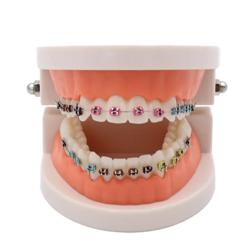 Dental Orthodontic Treatment Model with Ortho Metal Bracket Arch Wire Buccal Tube Ligature Ties
Dental Orthodontic Treatment Model with Ortho Metal Bracket Arch Wire Buccal Tube Ligature Ties