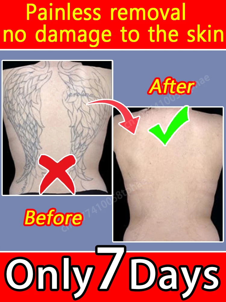 Нежный спрей для татуировок, быстро впитывающий туман, который выцветает, не оставляет липкий знак, маленькая бутылочка для удобного хранения и использования в любое время.
Нежный спрей для татуировок, быстро впитывающий туман, который выцветает, не оставляет липкий знак, маленькая бутылочка для удобного хранения и использования в любое время.