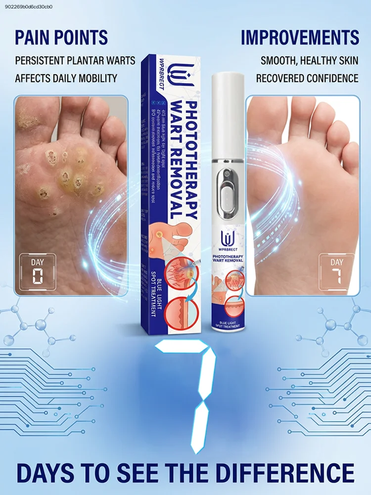 ᵂᵃʳᵗ ʳᵉᵐᵒᵛᵃˡ ᵃᵗ ʰᵒᵐᵉ ⁱˢ ˢᵘᵖᵉʳ ᶜᵒⁿᵛᵉⁿⁱᵉⁿᵗ! Warts will gradually fall off 2026
ᵂᵃʳᵗ ʳᵉᵐᵒᵛᵃˡ ᵃᵗ ʰᵒᵐᵉ ⁱˢ ˢᵘᵖᵉʳ ᶜᵒⁿᵛᵉⁿⁱᵉⁿᵗ! Warts will gradually fall off 2026