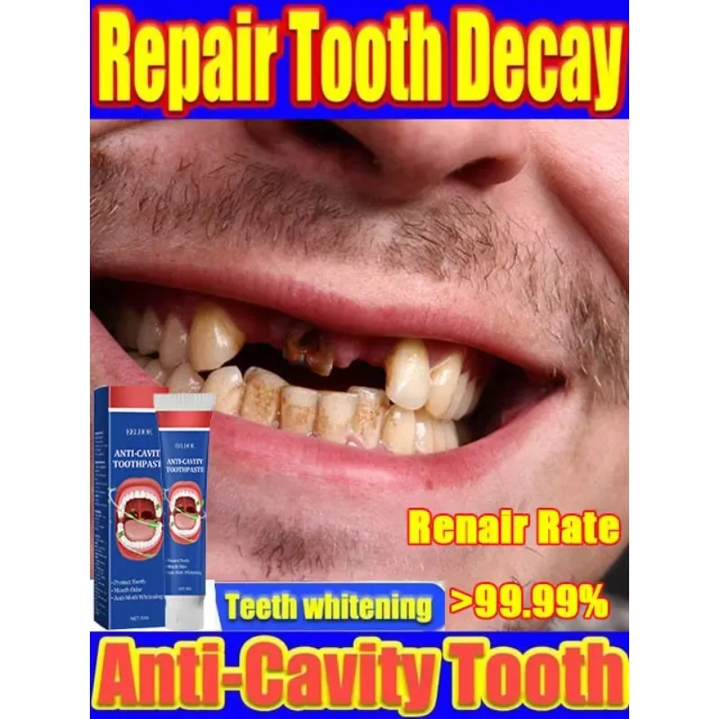 16 Advanced Dental Care: Teeth whitening anti, Anti-Cavity, Fresh Breath, Plaque Removal, Toothache Relief, Periodontitis Repair
16 Advanced Dental Care: Teeth whitening anti, Anti-Cavity, Fresh Breath, Plaque Removal, Toothache Relief, Periodontitis Repair
