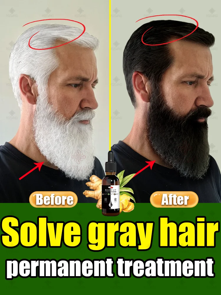 Removes gray hair, restores natural hair color, darkens hair from the root, pure natural plant extracts, 99% of people repurchas
Removes gray hair, restores natural hair color, darkens hair from the root, pure natural plant extracts, 99% of people repurchas