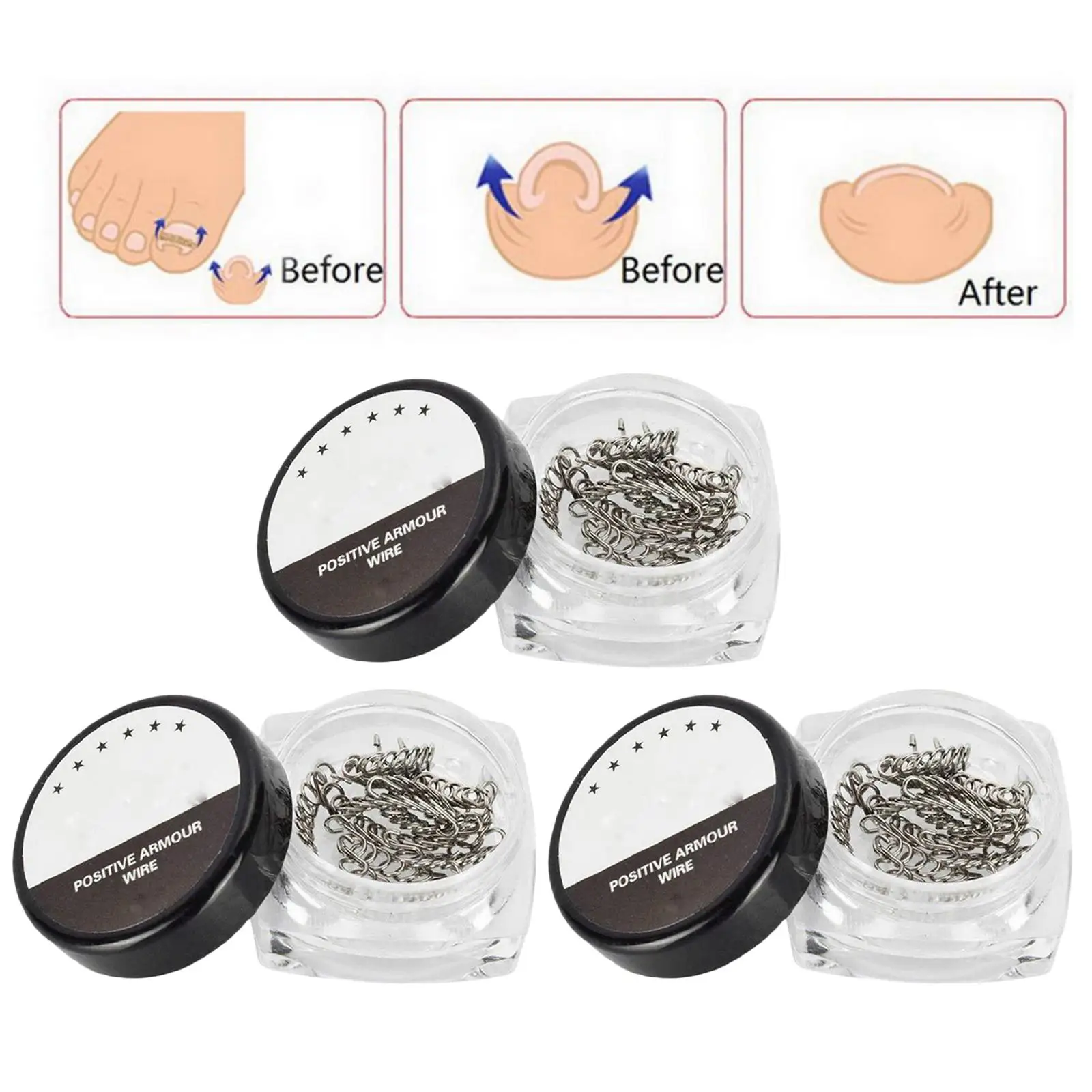 36pcs 3 box Ingrown Toenails Corrector Wire Recover Care Foot Nail Art
36pcs 3 box Ingrown Toenails Corrector Wire Recover Care Foot Nail Art