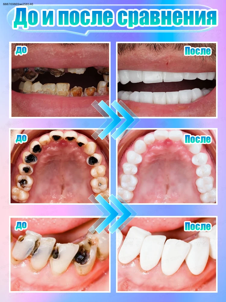 7-day program for a dazzling, confident smile
7-day program for a dazzling, confident smile
