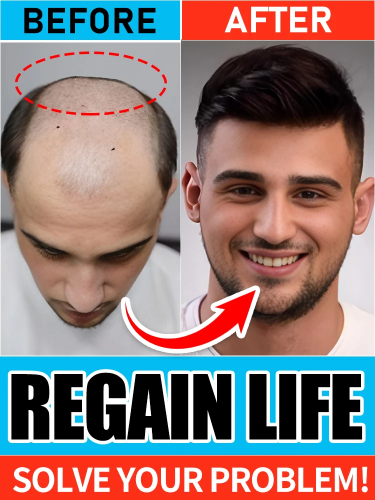 Hair Growth Essential Loss Regrowth Treatment Strengthens Hair Nourishes Scalp Light Weight Non Greasy Improve Scalp Circulation
Hair Growth Essential Loss Regrowth Treatment Strengthens Hair Nourishes Scalp Light Weight Non Greasy Improve Scalp Circulation
