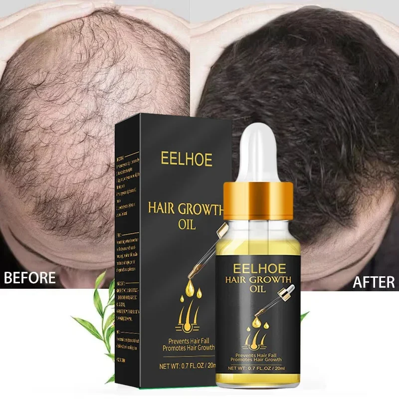 Fast Hair Growth Serum Hair Regrowth Essential Oil Anti Hair loss Repair Damaged Scalp Women Men Anti Baldness Hair Growth Care
Fast Hair Growth Serum Hair Regrowth Essential Oil Anti Hair loss Repair Damaged Scalp Women Men Anti Baldness Hair Growth Care